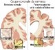 /plume/xmedia/fantasy/news/zapping/thumb/alzheimer_thumb.jpg